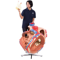 Load image into Gallery viewer, 3B Scientific Giant Human Heart Model, 8 times Life-Size - American Hospital Supply
