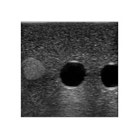 Load image into Gallery viewer, Paracentesis Ultrasound Training Model - American Hospital Supply
