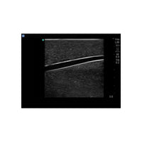 Load image into Gallery viewer, Gen II Central Line and Regional Anesthesia Replacement Insert - American Hospital Supply
