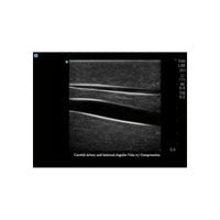 Load image into Gallery viewer, Gen II Central Line and Regional Anesthesia Replacement Insert - American Hospital Supply
