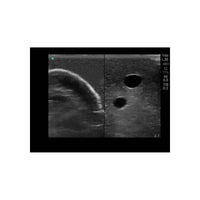 Load image into Gallery viewer, Gen II Central Line and Regional Anesthesia Replacement Insert - American Hospital Supply
