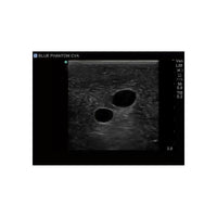 Load image into Gallery viewer, Gen II Central Line and Regional Anesthesia Replacement Insert - American Hospital Supply

