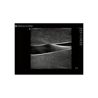 Load image into Gallery viewer, Gen II Central Line and Regional Anesthesia Replacement Insert - American Hospital Supply
