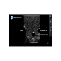 Load image into Gallery viewer, Gen II Central Line and Regional Anesthesia Replacement Insert - American Hospital Supply
