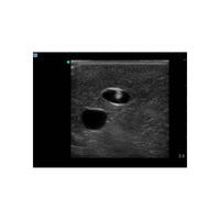Load image into Gallery viewer, Gen II Central Line and Regional Anesthesia Replacement Insert - American Hospital Supply
