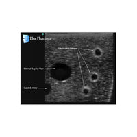 Load image into Gallery viewer, Gen II Central Line and Regional Anesthesia Replacement Insert - American Hospital Supply
