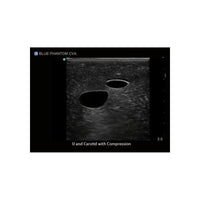 Load image into Gallery viewer, Gen II Central Line and Regional Anesthesia Replacement Insert - American Hospital Supply
