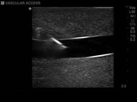 Load image into Gallery viewer, Gen II Ultrasound Central Line Training Model Replacement Tissue Insert - American Hospital Supply
