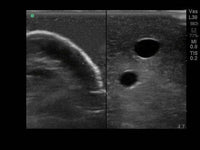 Load image into Gallery viewer, Gen II Ultrasound Central Line Training Model Replacement Tissue Insert - American Hospital Supply
