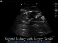 Load and play video in Gallery viewer, Renal Biopsy Ultrasound Training Model
