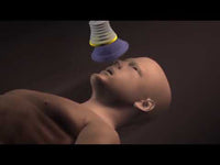 Load and play video in Gallery viewer, LifeVac Adult and Child Non-Invasive Choking First Aid Home Kit
