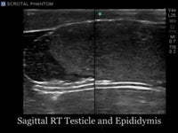 Load and play video in Gallery viewer, CAE Blue Phantom Scrotal Ultrasound Training Model
