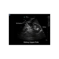 Load image into Gallery viewer, Renal Biopsy Ultrasound Training Model - American Hospital Supply
