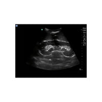 Load image into Gallery viewer, Renal Biopsy Ultrasound Training Model - American Hospital Supply
