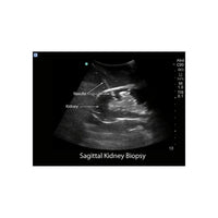 Load image into Gallery viewer, Renal Biopsy Ultrasound Training Model - American Hospital Supply
