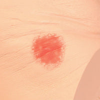 Load image into Gallery viewer, SEYMOUR II WOUND CARE MODEL™ - American Hospital Supply
