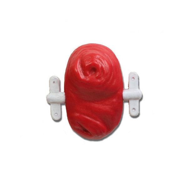 Vata Loop Stoma With Rod For Use With Otto Ostomy - American Hospital Supply