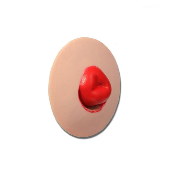 Vata Mucocutaneous Separation Stoma For Use With Otto Ostomy - American Hospital Supply