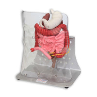 Load image into Gallery viewer, Vata Otto Ostomy Advanced Model With Case - American Hospital Supply
