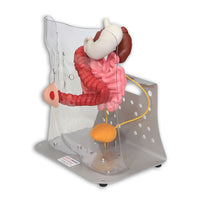 Load image into Gallery viewer, Vata Otto Ostomy Advanced Model With Case - American Hospital Supply
