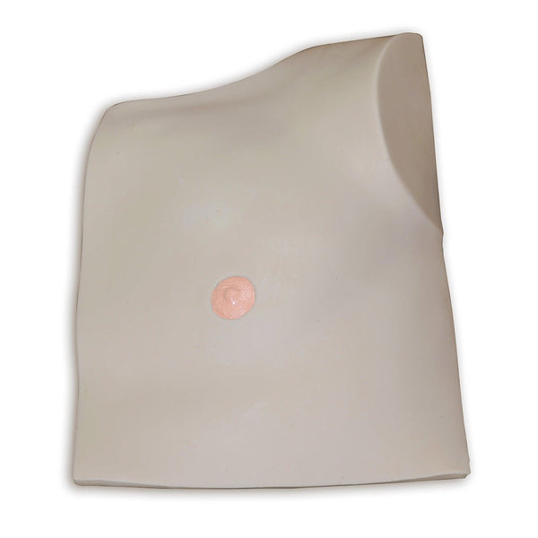 Vata Outer Tissue Flap Replacement For Chester - American Hospital Supply