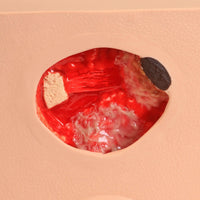 Load image into Gallery viewer, Vata Pat Pressure Injury Staging Model - American Hospital Supply
