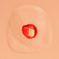 Load image into Gallery viewer, Vata Pat Pressure Injury Staging Model - American Hospital Supply

