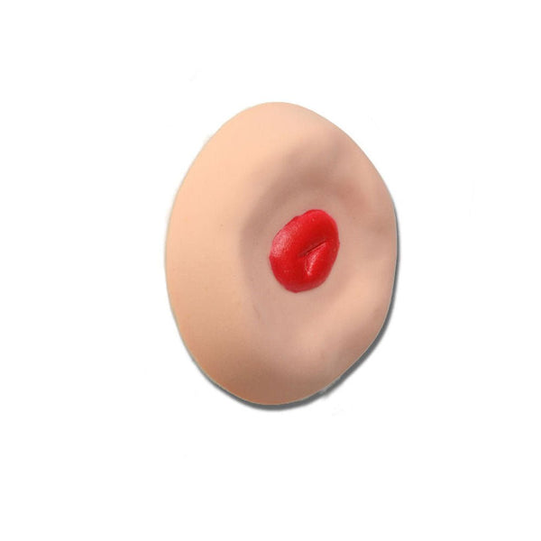 Vata Recessed Stoma For Use With Otto Ostomy - American Hospital Supply