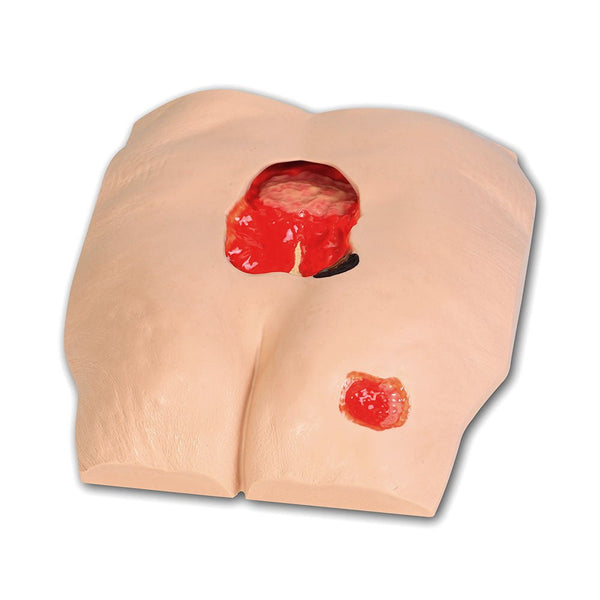 Vata Stan Stage 4 Pressure Injury Model - American Hospital Supply