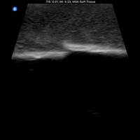Load image into Gallery viewer, Vata Ultrasound Phantom - Bone Fracture - American Hospital Supply
