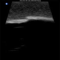 Load image into Gallery viewer, Vata Ultrasound Phantom - Bone Fracture - American Hospital Supply
