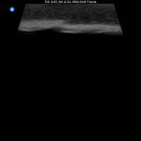 Load image into Gallery viewer, Vata Ultrasound Phantom - Bone Fracture - American Hospital Supply
