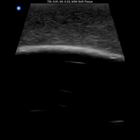 Load image into Gallery viewer, Vata Ultrasound Phantom - Bone Fracture - American Hospital Supply
