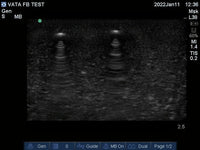 Load image into Gallery viewer, Vata Ultrasound Phantom - Foreign Body - American Hospital Supply
