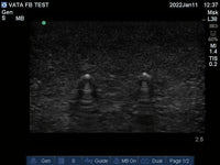 Load image into Gallery viewer, Vata Ultrasound Phantom - Foreign Body - American Hospital Supply
