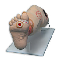 Load image into Gallery viewer, Vata Vinnie Venous Insufficiency Leg Model - American Hospital Supply
