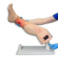 Load image into Gallery viewer, Vata Vinnie Venous Insufficiency Leg Model - American Hospital Supply
