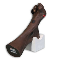 Load image into Gallery viewer, Vata Wilma Wound Foot - American Hospital Supply
