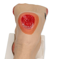 Load image into Gallery viewer, Vata Wilma Wound Foot - American Hospital Supply
