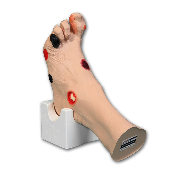 Vata Wilma Wound Foot - American Hospital Supply