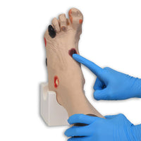 Load image into Gallery viewer, Vata Wilma Wound Foot - American Hospital Supply

