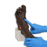 Load image into Gallery viewer, Vata Wilma Wound Foot - American Hospital Supply
