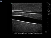 Load image into Gallery viewer, Blue Phantom Gen II Central Line Ultrasound Training Model, Hand Pump - American Hospital Supply
