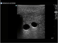 Load image into Gallery viewer, Blue Phantom Gen II Central Line Ultrasound Training Model, Hand Pump - American Hospital Supply
