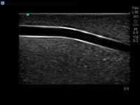Load image into Gallery viewer, CAE Blue Phantom Branched 2-Vessel Ultrasound Training Block - American Hospital Supply
