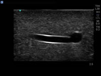 Load image into Gallery viewer, CAE Blue Phantom Branched 2-Vessel Ultrasound Training Block - American Hospital Supply

