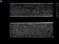 Load image into Gallery viewer, CAE Blue Phantom Branched 2-Vessel Ultrasound Training Block - American Hospital Supply
