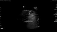 Load image into Gallery viewer, CAE Blue Phantom COVID-19 Lung Ultrasound Training Model - American Hospital Supply
