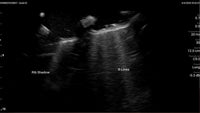 Load image into Gallery viewer, CAE Blue Phantom COVID-19 Lung Ultrasound Training Model - American Hospital Supply

