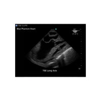 Load image into Gallery viewer, CAE Blue Phantom™ Heart Block Model - American Hospital Supply
